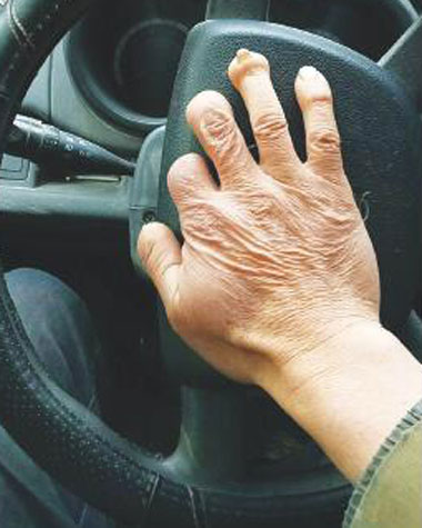 手指残缺能不能考驾照？